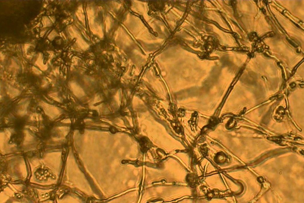 microscope image of cryptococcus hyphae with basidia and spores